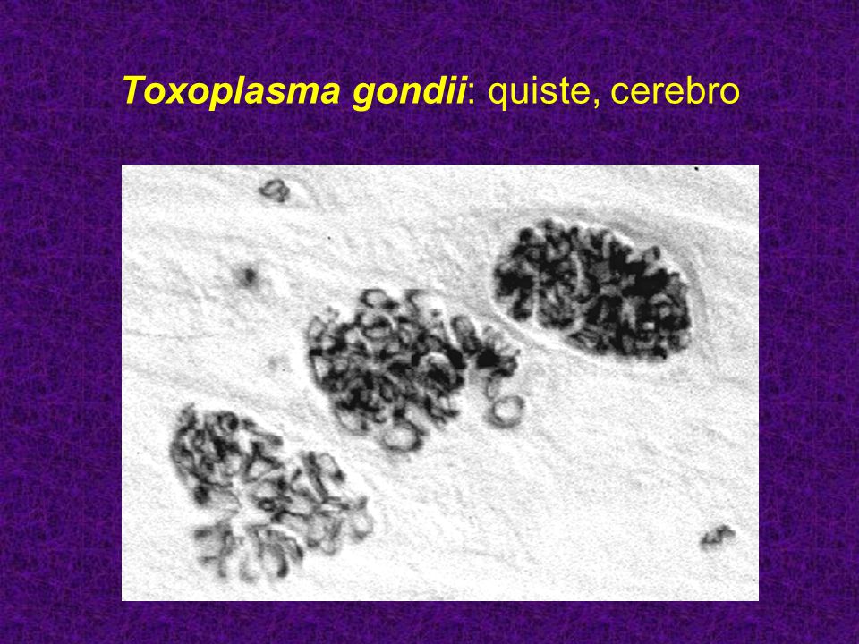 toxoplasma gondii норма toxoplasma gondii норма